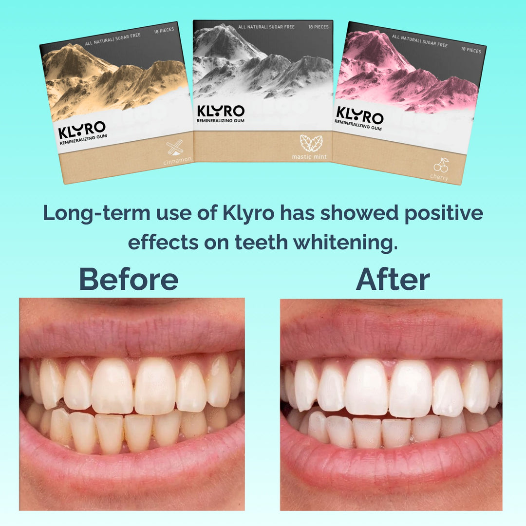 Klyro Remineralizing Gum (Buy 1 Get 1 FREE)